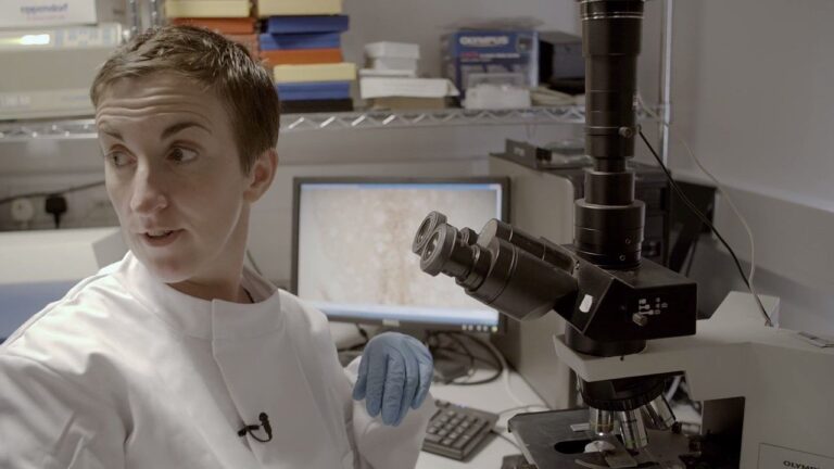 Parkinson's disease research