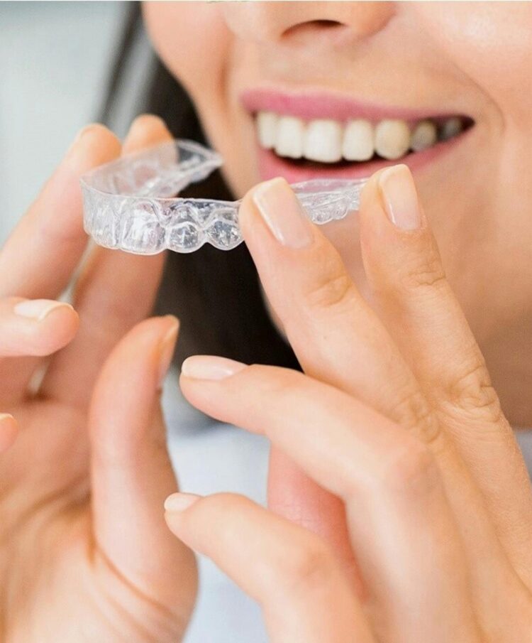 invisalign