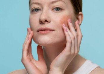 Best skincare for rosacea: An Irish skincare expert shares her advice